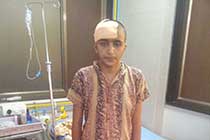 Brain Abscess Post OP 2 Clinical