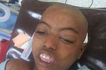 Brain Abscess PRE OP Clinical 1