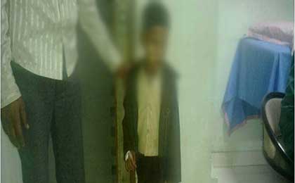 clinical photo of brainstem glioma