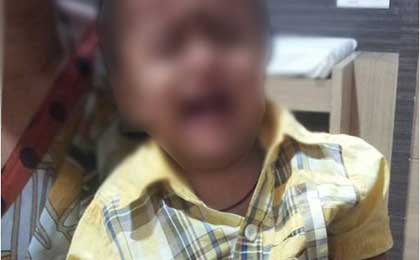 clinical post rcovery conservative treatment